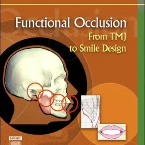 Warranty Included Functional Occlusion: From TMJ to Smile Design
